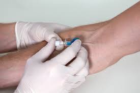 The Eight-stick Day or Colonoscopy from&nbsp;H#$l